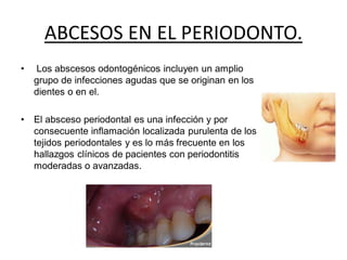 ABCESOS EN EL PERIODONTO.
• Los abscesos odontogénicos incluyen un amplio
grupo de infecciones agudas que se originan en los
dientes o en el.
• El absceso periodontal es una infección y por
consecuente inflamación localizada purulenta de los
tejidos periodontales y es lo más frecuente en los
hallazgos clínicos de pacientes con periodontitis
moderadas o avanzadas.
 