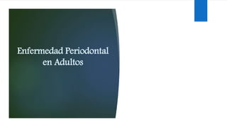 Enfermedad Periodontal
en Adultos
 