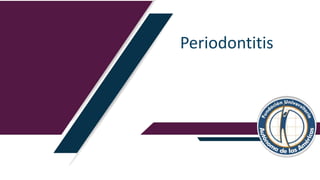 Periodontitis
 