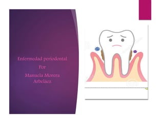 ENFERMEDAD
PERIODONTAL
Enfermedad periodontal
Por
Manuela Morera
Arbeláez
 