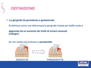  La gengivite da gravidanza o gestazionale
Si definisce come una infiammazione gengivale iniziata per biofilm orale e
aggravata da un aumento dei livelli di ormoni sessuali
endogeni
Se non curata può evolvere in parodontite
DEFINIZIONE
GENGIVITE PARODONTITE
 
