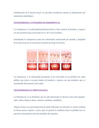 Enfermedad periodontal y osteoporosis