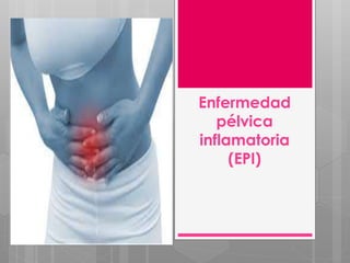Enfermedad
pélvica
inflamatoria
(EPI)
 