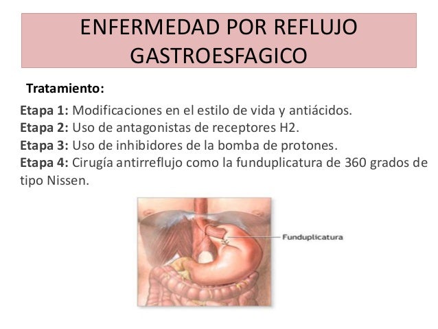 Las clínicas de la dependencia alcohólica en tule
