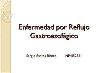 Enfermedad por Reflujo
    Gastroesofágico

  Sergio Bustos Blanco   NP: 552351
 