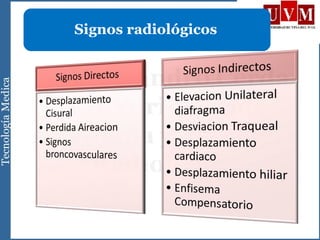 Signos RadiologicosSignos radiológicos
 