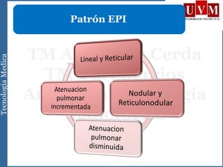 Patrón EPI
 