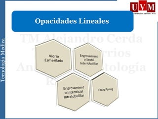 Opacidades Lineales
 