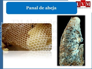 Panal de abeja
 