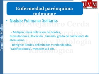 Enfermedad parénquima
pulmonar
 