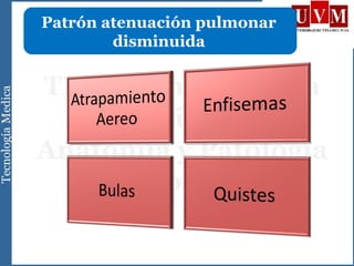 Patrón atenuación pulmonar
disminuida
 