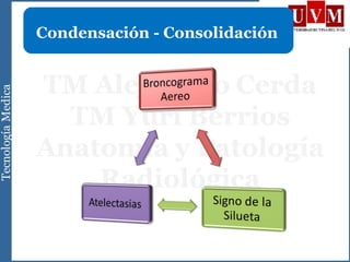 Condensación - Consolidación
 