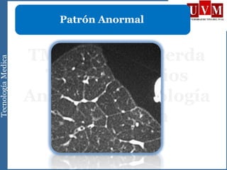 Patrón Anormal
 