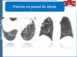 Patrón en panal de abeja
 