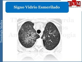 Signo Vidrio Esmerilado
 