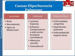 Causas Hiperlucencia
Pulmonar
 