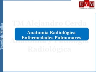 Anatomía Radiológica
Enfermedades Pulmonares
 