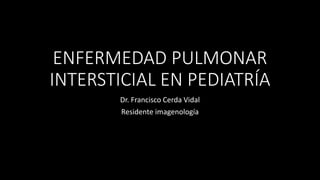 ENFERMEDAD PULMONAR
INTERSTICIAL EN PEDIATRÍA
Dr. Francisco Cerda Vidal
Residente imagenología
 
