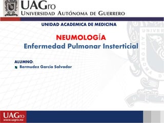 UNIDAD ACADEMICA DE MEDICINA
NEUMOLOGÍA
Enfermedad Pulmonar Insterticial
ALUMNO:
Bermudez Garcia Salvador
 