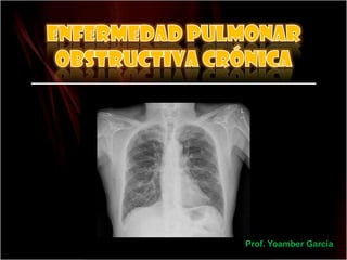 Enfermedad pulmonar obstructiva crónica Prof. Yoamber García 