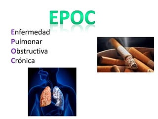 Enfermedad
Pulmonar
Obstructiva
Crónica
 