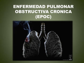 ENFERMEDAD PULMONAR
OBSTRUCTIVA CRONICA
(EPOC)
 