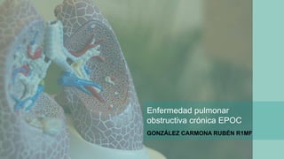 Enfermedad pulmonar
obstructiva crónica EPOC
GONZÁLEZ CARMONA RUBÉN R1MF
 