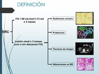 ERC
FG < 60 mL/min/1,73 m2
x 3 meses
Lesión renal x 3 meses
(con o sin descenso FG)
Técnicas de imagen
Sedimento urinario
Proteinuria
Alteraciones en BR
DEFINICIÓN
 