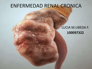 ENFERMEDAD RENAL CRONICA
LUCIA M.UBEDA F.
100097322
 