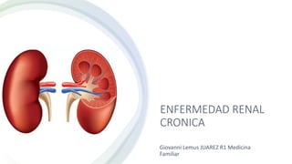 ENFERMEDAD RENAL
CRONICA
Giovanni Lemus JUAREZ R1 Medicina
Familiar
 