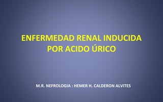ENFERMEDAD RENAL INDUCIDA
POR ACIDO ÚRICO
M.R. NEFROLOGIA : HEMER H. CALDERON ALVITES
 