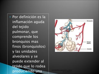 Por definición es la inflamación aguda del tejido pulmonar, que comprende los bronquios mas finos (bronquiolos) y las unidades alveolares y se puede extender al tejido que lo rodea produciendo una condensación ENFERMERA DOCENTE LORNA GUAJARDO V. 