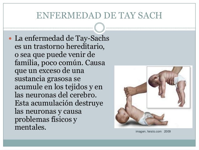 Enfermedad tay sach