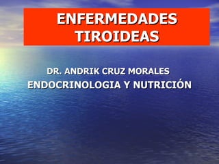 ENFERMEDADES TIROIDEAS DR. ANDRIK CRUZ MORALES   ENDOCRINOLOGIA Y NUTRICIÓN 