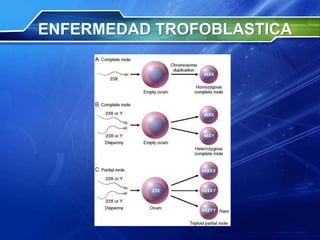 ENFERMEDAD TROFOBLASTICA
 