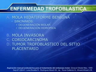 ENFERMEDAD TROFOBLASTICA
A. MOLA HIDATIFORME BENIGNA
 SINONIMOS:
• DEGENERACIÓN MOLAR
• DEGENERACIÓN HIDRÓPICA
B. MOLA INVASORA
C. CORIOCARCINOMA
D. TUMOR TROFOBLASTICO DEL SITIO
PLACENTARIO
Aspiración manual endouterina para el tratamiento del embarazo molar. Ginecol Obstet Mex. 1999
Sep;67:438-41. Lara-Ricalde R., Rodriguez-Bosch M., de , Tovar-Calleros G., Ahued-Ahued J.R.
 