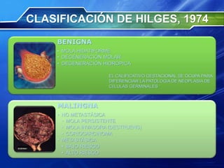 CLASIFICACIÓN DE HILGES, 1974
BENIGNA
• MOLA HIDATIFORME
• DEGENERACIÓN MOLAR
• DEGENERACIÓN HIDRÓPICA
MALINGNA
• NO METASTÁSICA
• MOLA PERSISTENTE
• MOLA INVASORA (DESTRUENS)
• CORIOCARCINOMA
• METASTÁSICA
• BAJO RIESGO
• ALTO RIESGO
EL CALIFICATIVO GESTACIONAL SE OCUPA PARA
DIFERENCIAR LA PATOLOGÍA DE NEOPLASIA DE
CÉLULAS GERMINALES
 