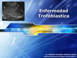 LOGO
Enfermedad
Trofoblastica
Dr. Rodolfo González Andérica R1GO
Instituto Mexicano del Seguro Social HGRO-1
 