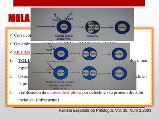 MOLA PARCIAL
 Cursa como aborto, llegando a nacer solo 1/50.000
 Generalmente triploide (69 XXY > 69XYY / NO 69YYY).
 MECANISMO:
1. POLISPERMIA: mas frecuente, un ovocito es fertilizado por dos o mas
espermatozoides haploides.
2. Ovocito es fertilizado por un espermatozoide diploide, por un defecto en
la primera división meiotica del mismo. (infrecuente)
3. Fertilización de un ovocito diploide por defecto en su primera división
meiotica. (infrecuente)
Revista Española de Patología. Vol. 35, Num 2;2003
 