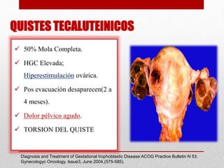 QUISTES TECALUTEINICOS
 50% Mola Completa.
 HGC Elevada;
Hiperestimulación ovárica.
 Pos evacuación desaparecen(2 a
4 meses).
 Dolor pélvico agudo.
 TORSION DEL QUISTE
Diagnosis and Treatment of Gestational trophoblastic Disease:ACOG Practice Bulletin N 53.
Gynecologyc Oncology. Issue3, June 2004,(575-585).
 
