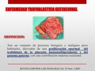 ENFERMEDAD TROFOBLASTICA GESTACIONAL
Son un conjunto de procesos benignos y malignos poco
habituales, derivados de una proliferación anormal del
trofoblasto de la placenta humana(hiperplasia) y del
genoma paterno, con una contribución materna ocasional.
REVISTA ESPAÑOLA DE PATOLOGIA Vol. 35 Num. 2,2003
 