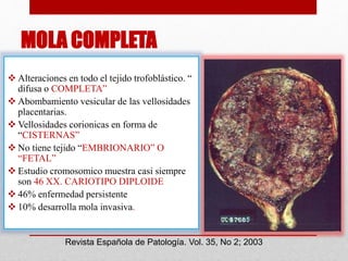 MOLA COMPLETA
 Alteraciones en todo el tejido trofoblástico. “
difusa o COMPLETA”
 Abombamiento vesicular de las vellosidades
placentarias.
 Vellosidades corionicas en forma de
“CISTERNAS”
 No tiene tejido “EMBRIONARIO” O
“FETAL”
 Estudio cromosomico muestra casi siempre
son 46 XX. CARIOTIPO DIPLOIDE
 46% enfermedad persistente
 10% desarrolla mola invasiva.
Revista Española de Patología. Vol. 35, No 2; 2003
 