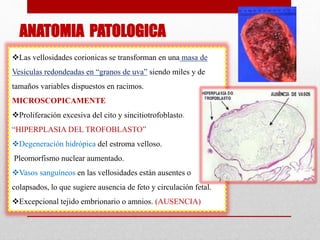 ANATOMIA PATOLOGICA
Las vellosidades corionicas se transforman en una masa de
Vesículas redondeadas en “granos de uva” siendo miles y de
tamaños variables dispuestos en racimos.
MICROSCOPICAMENTE
Proliferación excesiva del cito y sincitiotrofoblasto.
“HIPERPLASIA DEL TROFOBLASTO”
Degeneración hidrópica del estroma velloso.
Pleomorfismo nuclear aumentado.
Vasos sanguíneos en las vellosidades están ausentes o
colapsados, lo que sugiere ausencia de feto y circulación fetal.
Excepcional tejido embrionario o amnios. (AUSENCIA)
 