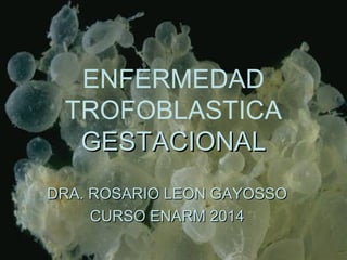 ENFERMEDAD
TROFOBLASTICA
GESTACIONALGESTACIONAL
DRA. ROSARIO LEON GAYOSSODRA. ROSARIO LEON GAYOSSO
CURSO ENARM 2014CURSO ENARM 2014
 