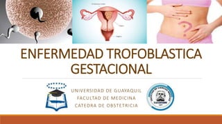ENFERMEDAD TROFOBLASTICA
GESTACIONAL
UNIVERSIDAD DE GUAYAQUIL
FACULTAD DE MEDICINA
CATEDRA DE OBSTETRICIA
 