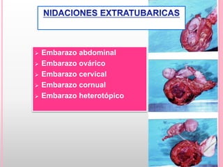  Embarazo abdominal
 Embarazo ovárico
 Embarazo cervical
 Embarazo cornual
 Embarazo heterotópico
 
