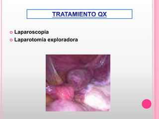  Laparoscopia
 Laparotomía exploradora
 
