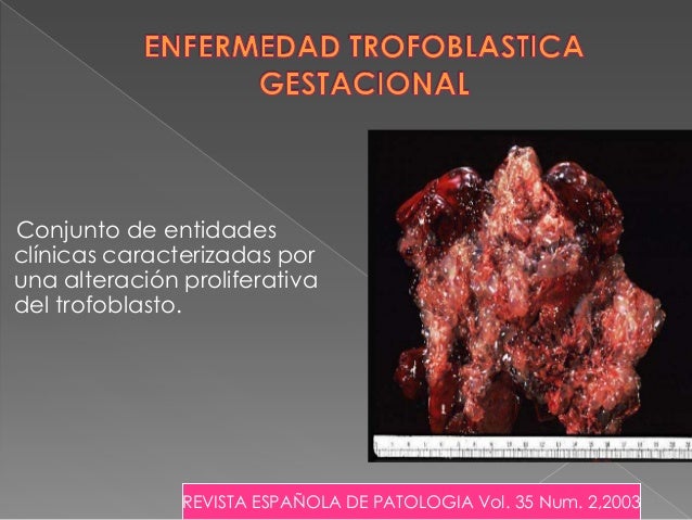 Tumor del sitio placentario pdf