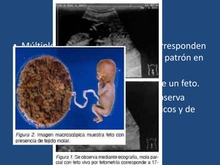 Etiología ecográfica
• Múltiples áreas hipoecoicas que corresponden
a las vellosidades hidrópicas con un patrón en
tormenta de nieve.
• No hay saco gestacional normal o de un feto.
• En la mola hidatiforme parcial se observa
áreas focales de cambios trofoblásticos y de
tejido fetal.
 