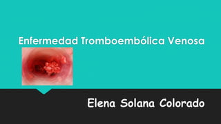 Enfermedad Tromboembólica Venosa

Elena Solana Colorado

 